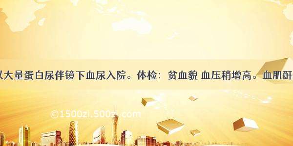 女 19岁。以大量蛋白尿伴镜下血尿入院。体检：贫血貌 血压稍增高。血肌酐140μmol/L