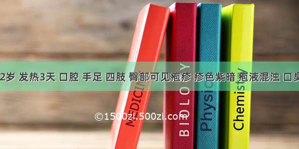 患儿 2岁 发热3天 口腔 手足 四肢 臀部可见疱疹 疹色紫暗 疱液混浊 口臭流涎