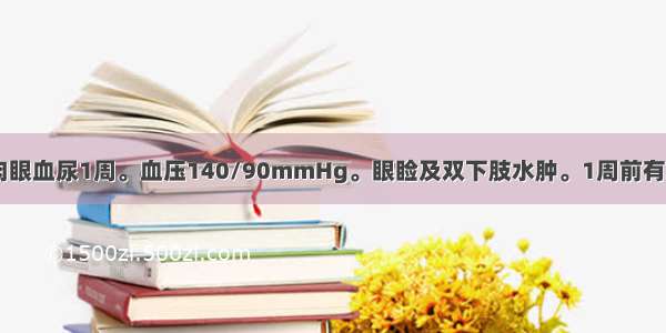 男性 15岁。肉眼血尿1周。血压140/90mmHg。眼睑及双下肢水肿。1周前有发热 咽痛。尿